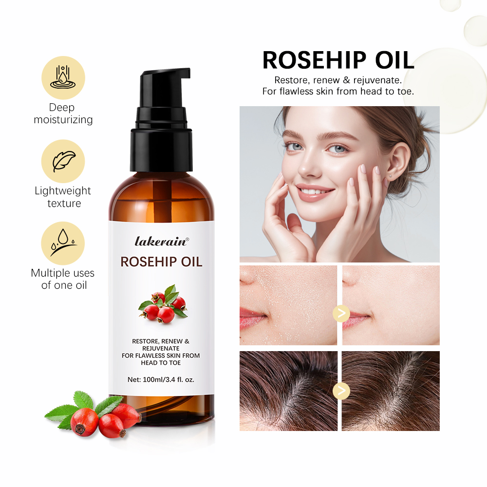 Face Oil Rosehip - 100ml มัลติฟังก์ชั่ชุ่มชื่น Rosehip Essential Oil ต่อต้านริ้วรอย