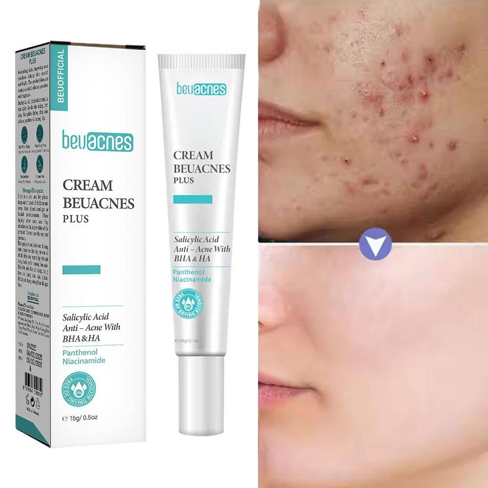 ใหม่ 20g Niacinamide Acne Gel  - Skincare Niacinamide บทวิจารณ์และราคา