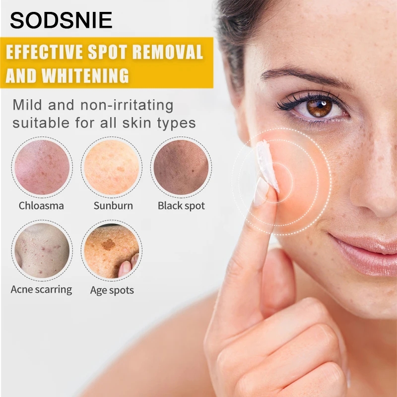 เครื่องกำจัดจุดด่างดำวิตามินซี - Skincare Niacinamide บทวิจารณ์และราคา