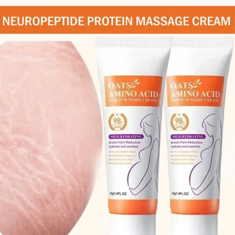 ครีมลบรอยแตกลายถาวร ลดรอยแตกลา - Skincare Oat บทวิจารณ์และราคา
