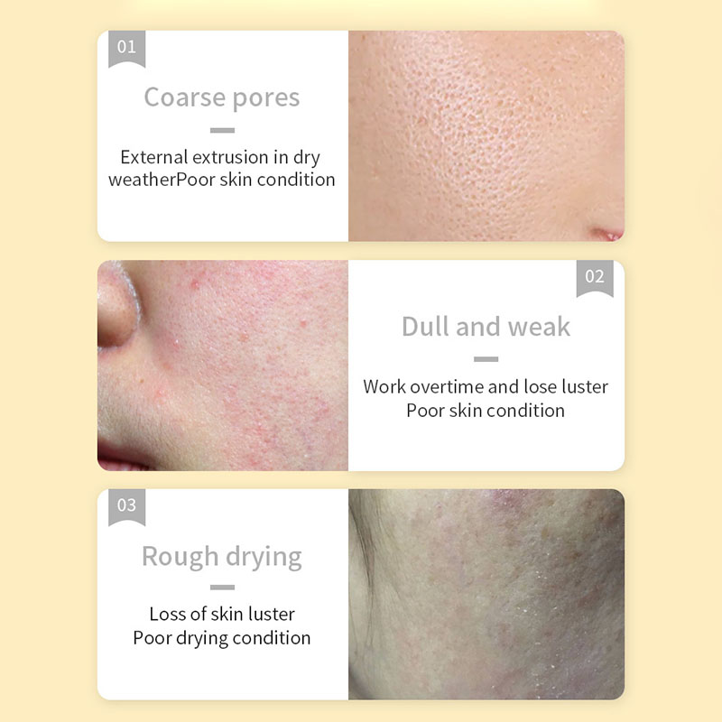 มาส์กหน้าวิตามินซี SADOER 30 ช - Skincare Omg บทวิจารณ์และราคา