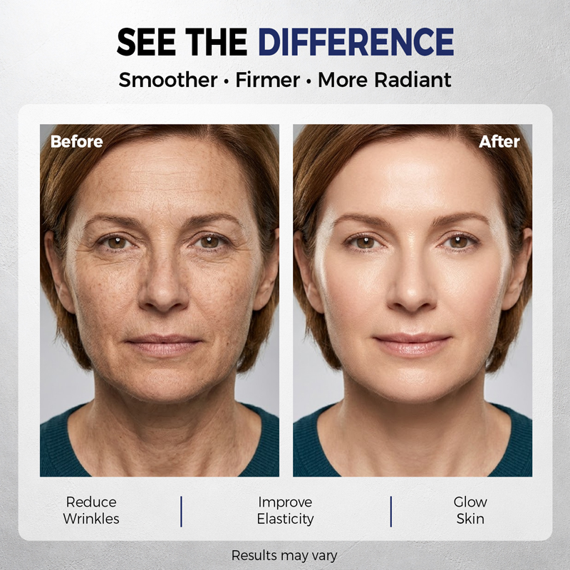 ครีมบำรุงผิวหน้าเรตินอลครีมลดร - Skincare Retinol บทวิจารณ์และราคา