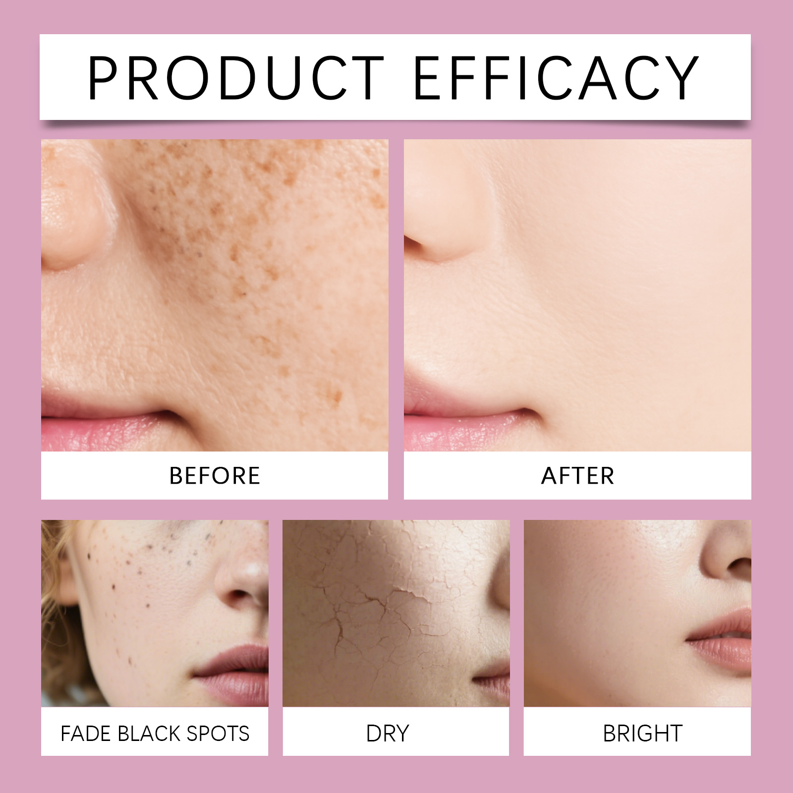 ชุดผลิตภัณฑ์บำรุงผิวหน้าคอลลาเ - Skincare Niacinamide บทวิจารณ์และราคา